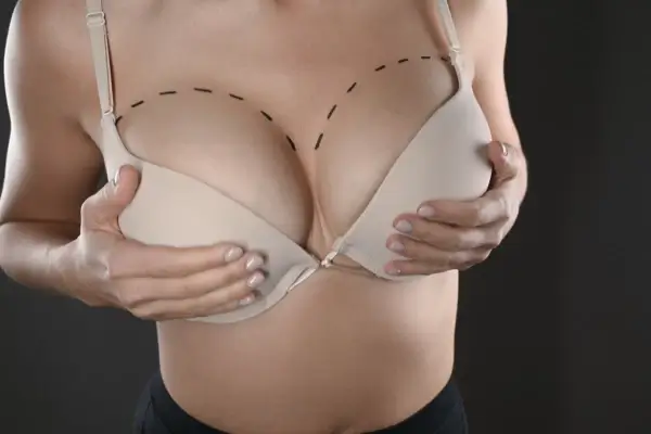 Elevación de mamas (mastopexia)