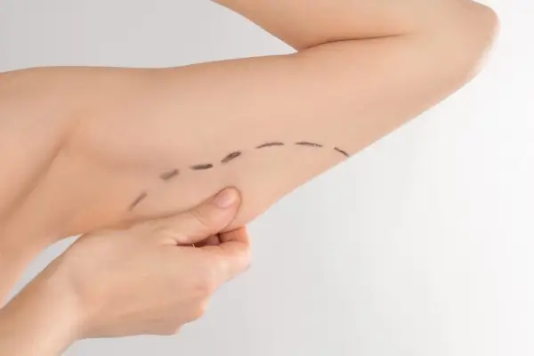 Braquioplastia Sabadell