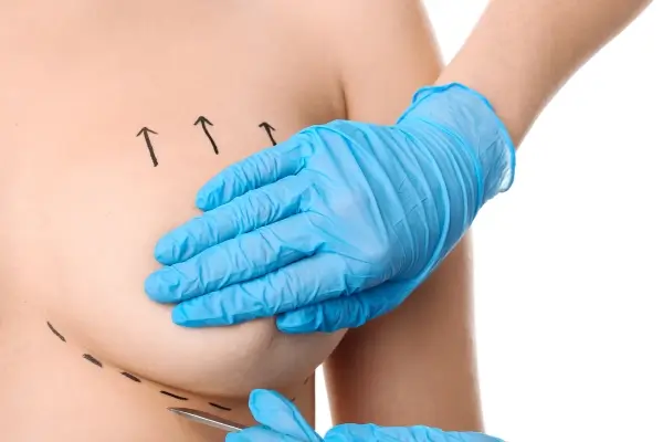 Elevación de mamas Sabadell