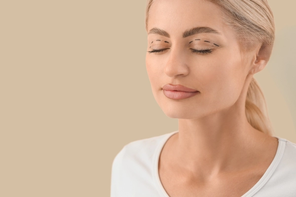 blefaroplastia-superior